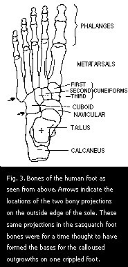 Figure 3. Bones of the human foot as seen from above.