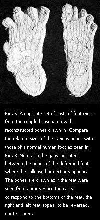 Figure 6. A duplicate set of casts of footprints from the crippled sasquatch with reconstructed bones drawn in.